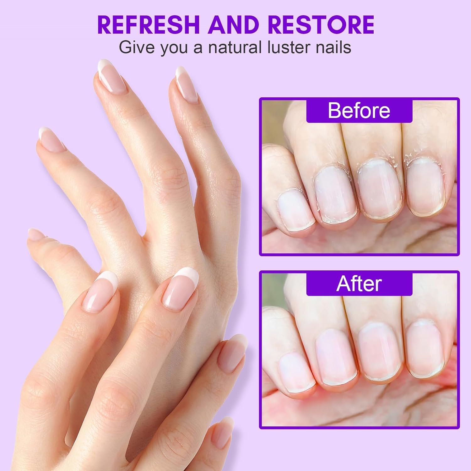 Makartt Cuticle Remover Kit, Nail Care Kit with 50ml Cuticle Softener, Cuticle Trimmer, Cuticle Oil Pen, Nail File & Cuticle Sticks, Manicure Kit for Cuticle Prep & Moisturize Salon Home Use - Image 7