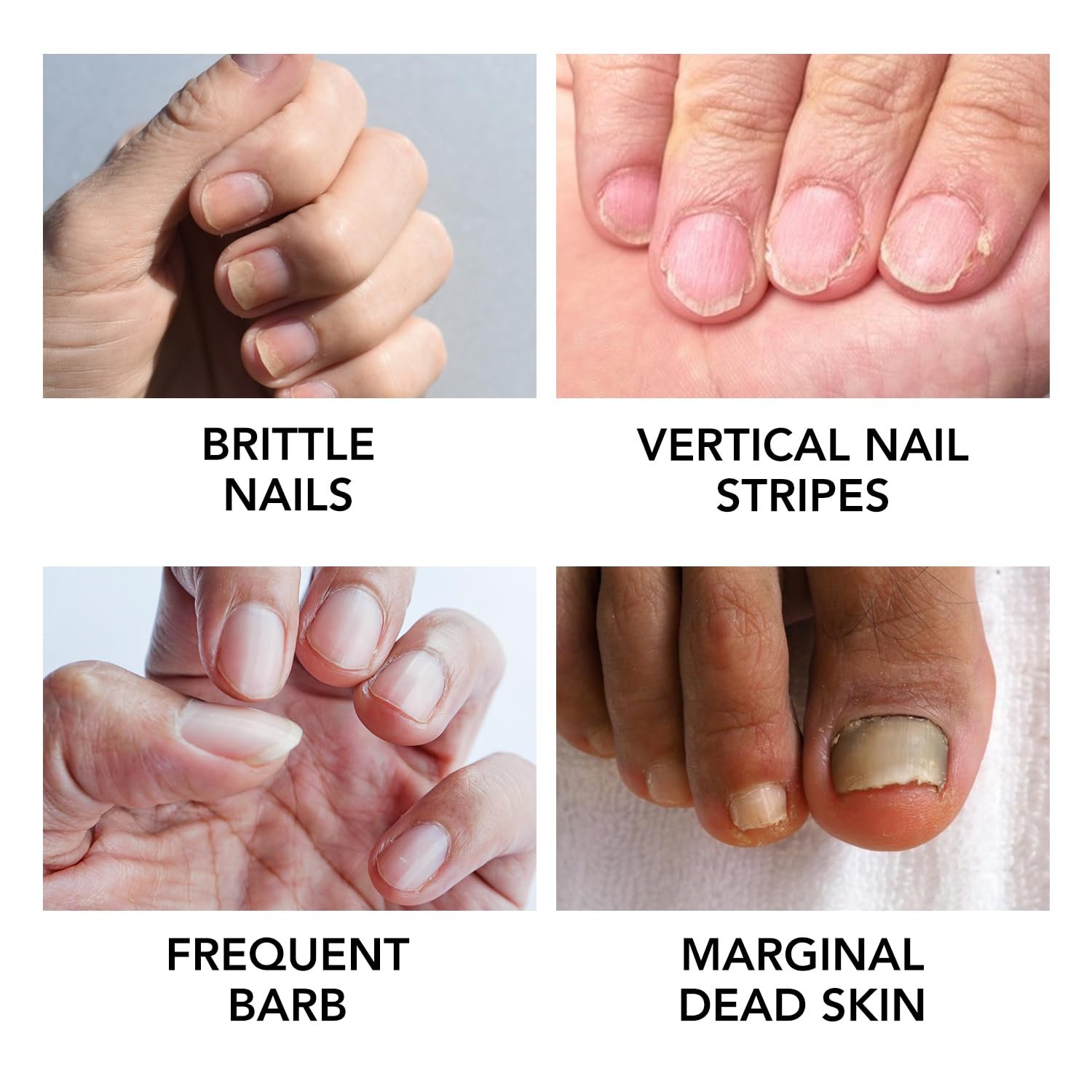 Moisturizing Cuticle Oil for Nails, Cosmetics Nail Growth Oil, Nails Cuticle Care Oil for Dry & Cracked Nails, Repairs Cuticles, Hydrating, Strengthen, Softening & Conditions Cuticle Area - Image 6