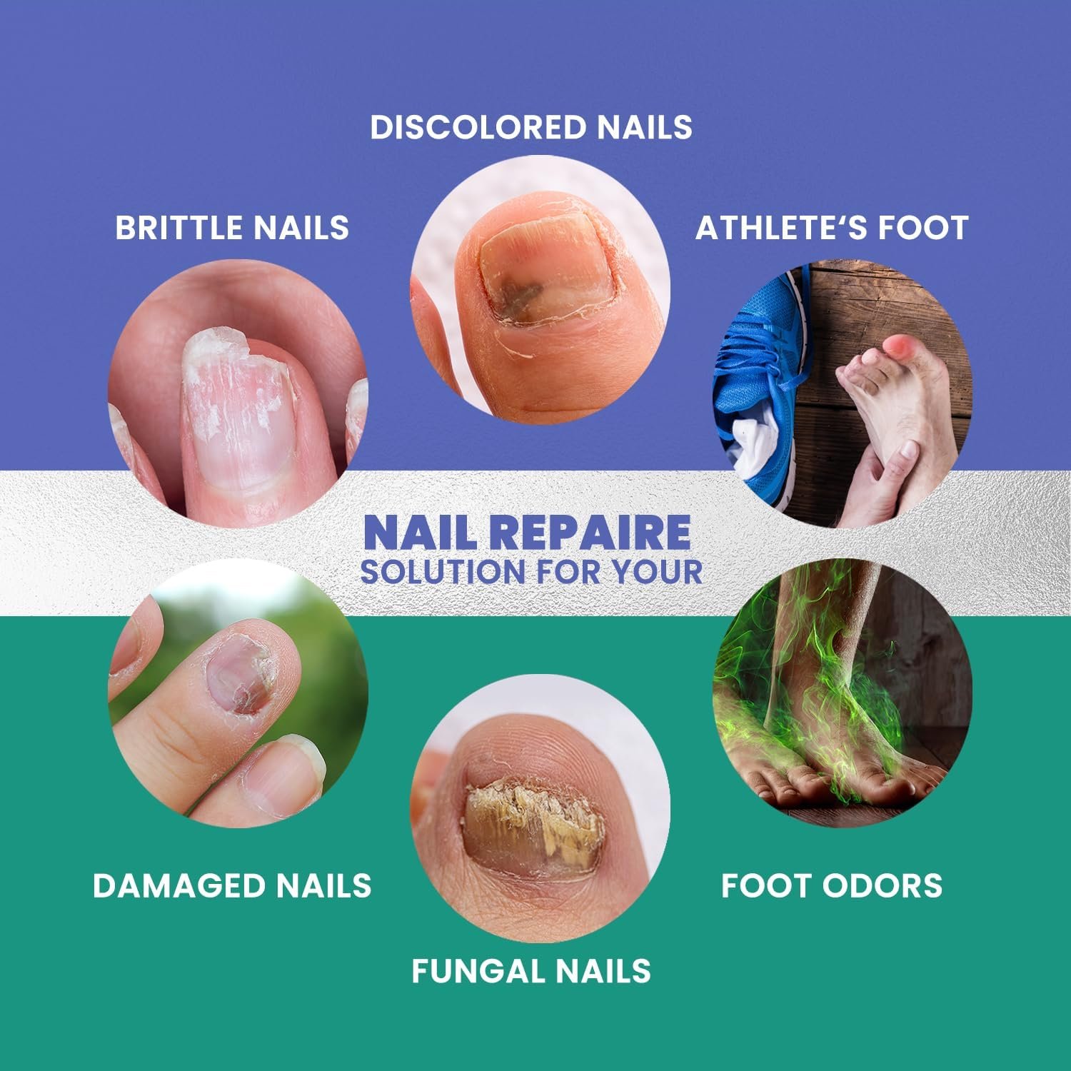 Toenail Fungus Treatment: Extra Strength Nail Fungus Treatment for Toenail & Fingernail, Nail Repair Solution for Thick Broken Discolored & Damaged Nail - Image 4