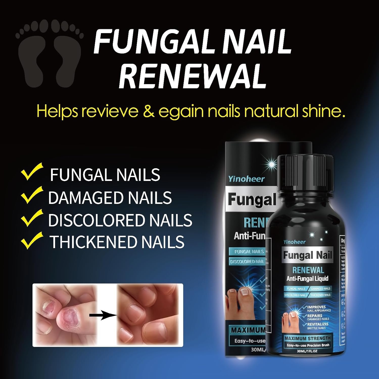 Toenail Fungus Treatment, Nail Fungus Treatment for Toenail, Nail Repair Solution, Fingernails Renewal Liquid For Damaged & Discoloration Nail, Nail Fungus Treatment, Safely and Gently - 30ML (1 FLOZ) - Image 5