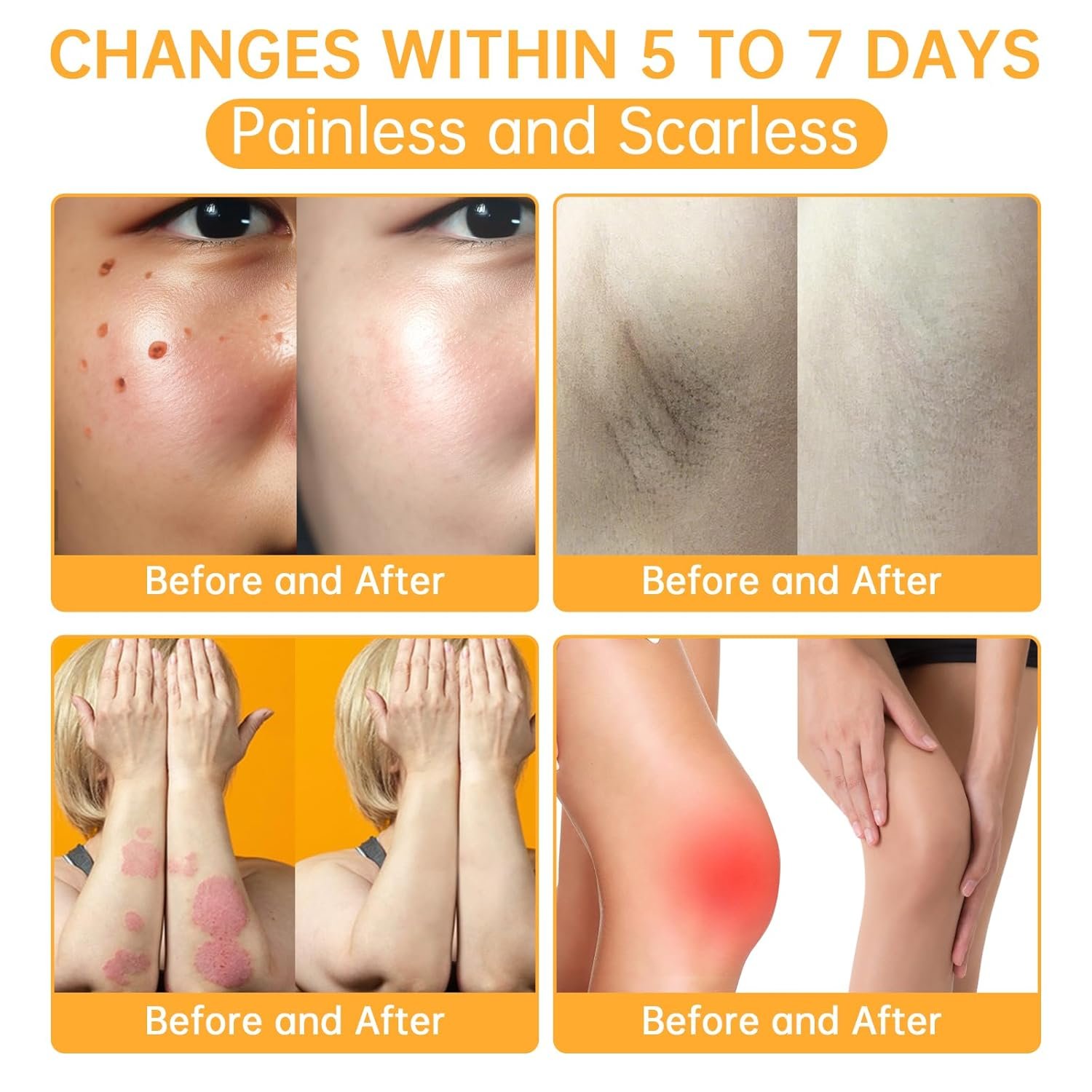 Bee Venom Removal Cream, New Professional Bee Venom Repair Cream Improves The Appearance of Skin, Bee Venom Moisturizing Cream for All Parts of The Body, Suitable for Women & Men, 2 OZ - Image 6