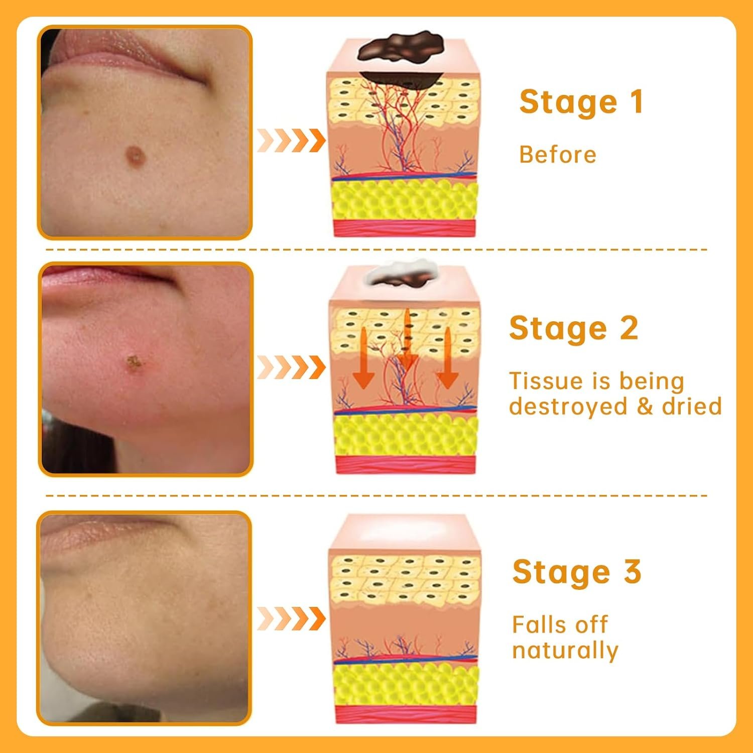 Bee Venom Removal Cream, New Professional Bee Venom Repair Cream Improves The Appearance of Skin, Bee Venom Moisturizing Cream for All Parts of The Body, Suitable for Women & Men, 2 OZ - Image 5