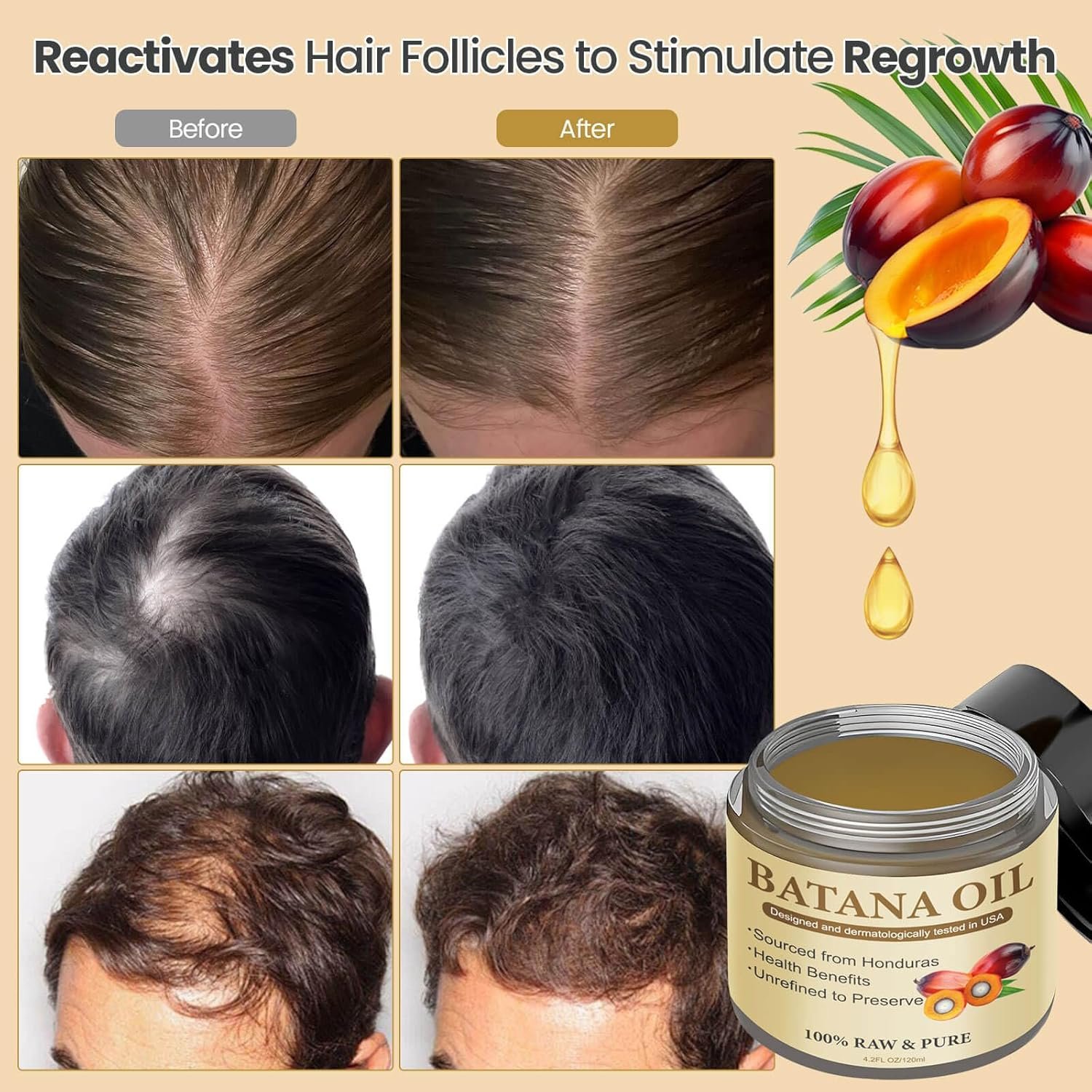 Raw Batana Oil from Honduras,Unrefined, Organic and Natural Ingredients - Promotes Hair Growth and Thickness for Men & Women, 100% Pure, 4.3 OZ - Image 5