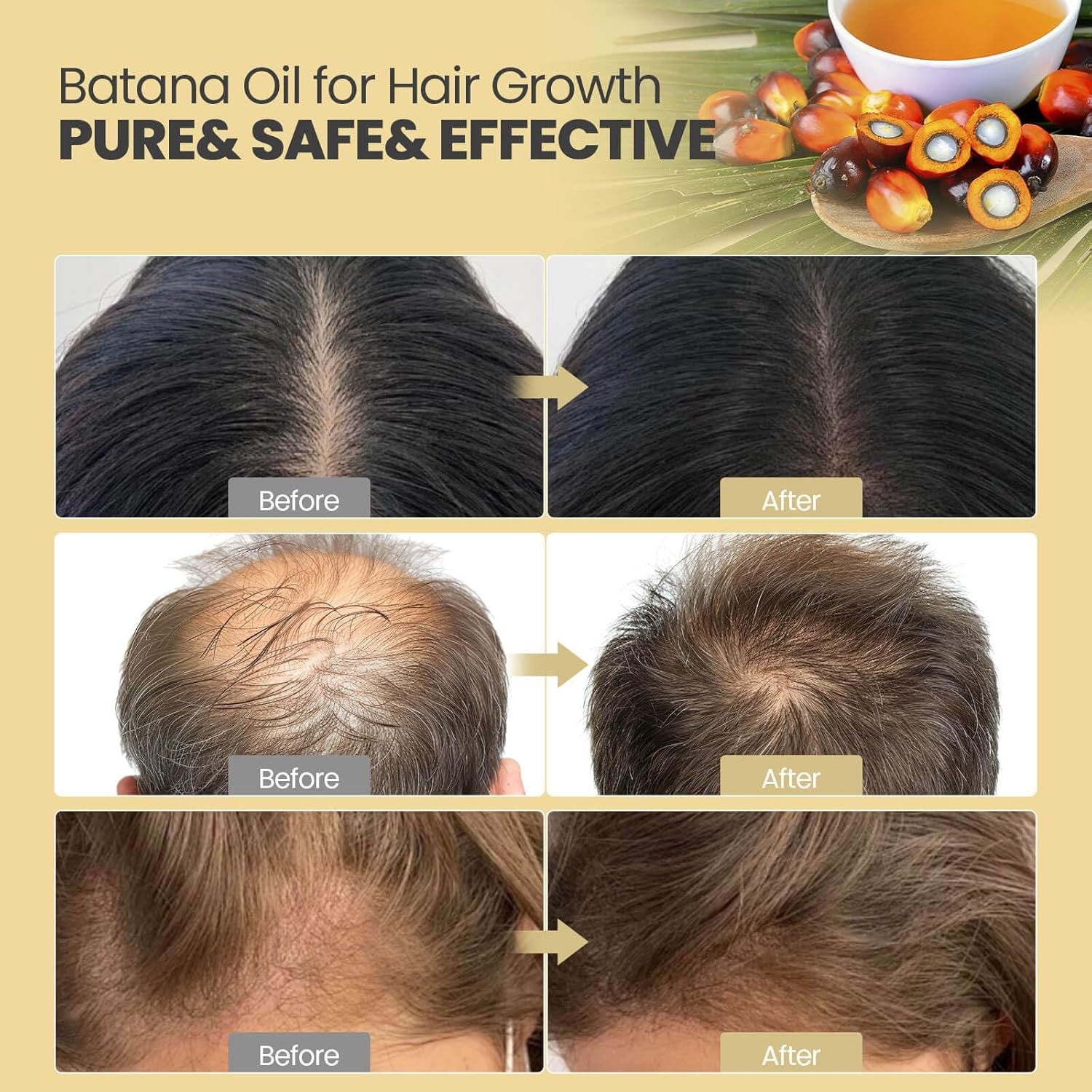 Raw Batana Oil from Honduras,Unrefined, Organic and Natural Ingredients - Promotes Hair Growth and Thickness for Men & Women, 100% Pure, 4.3 OZ - Image 4