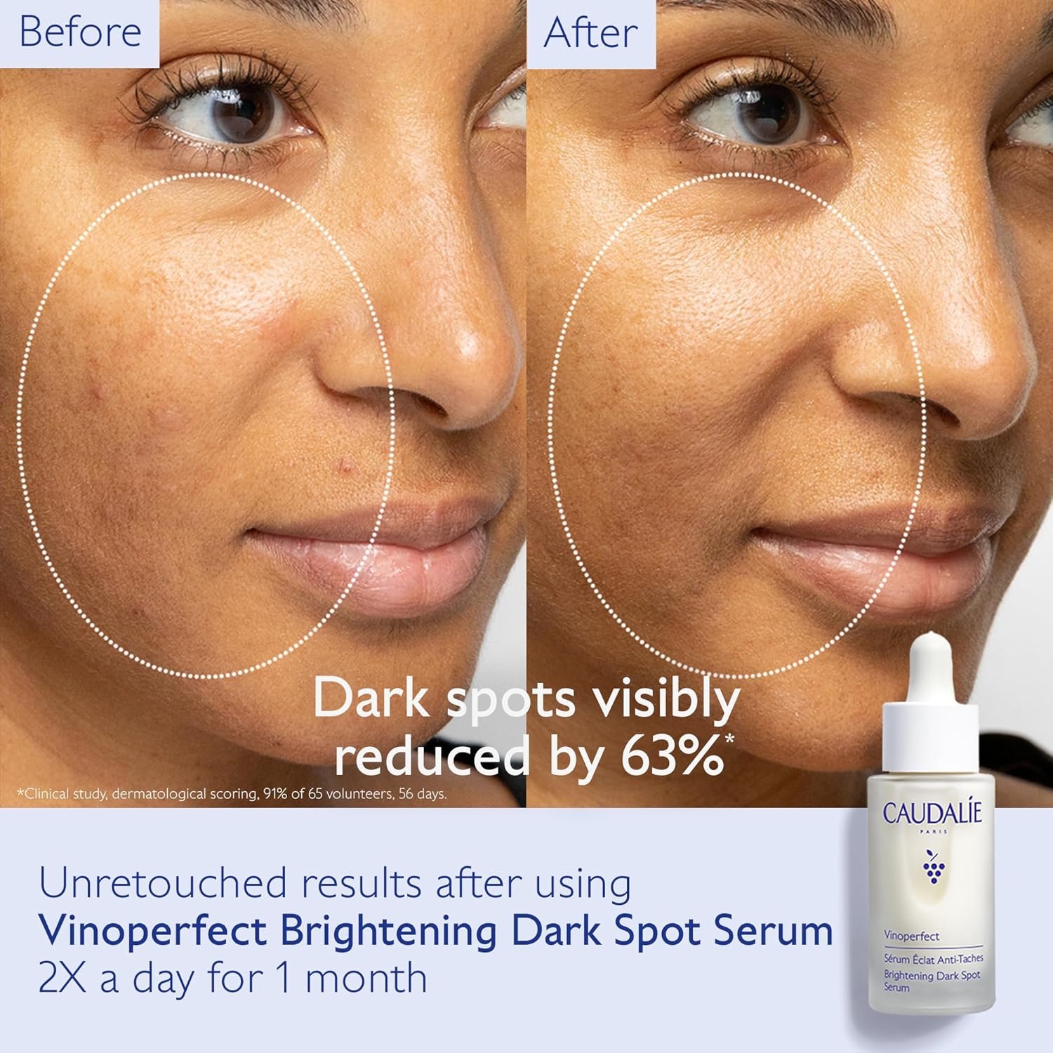 Caudalie Vinoperfect Brightening Dark Spot Serum, Dark Spot Corrector 62x More Effective than Vitamin C, Skin Brightening Serum with Viniferine, 1 Fl Oz - Image 3