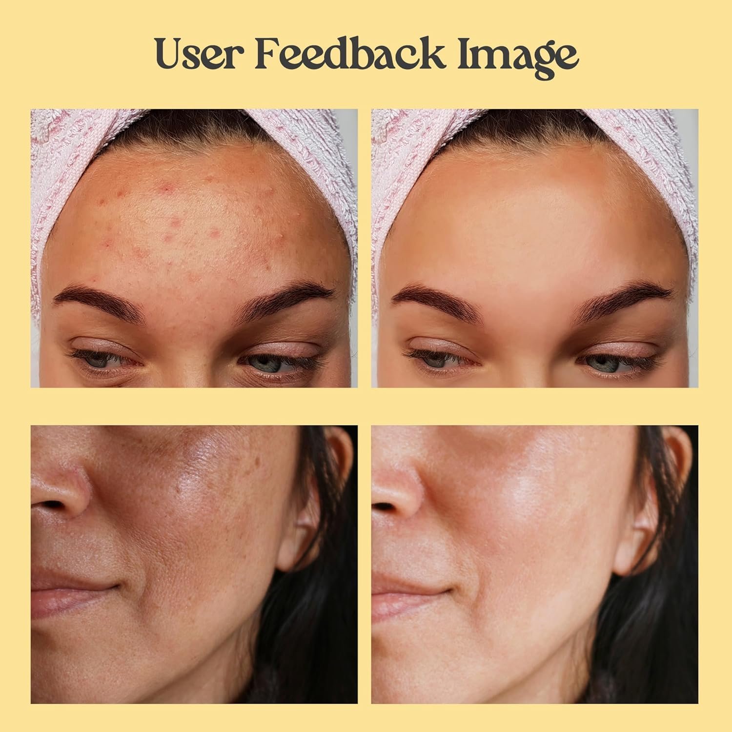 Neatique Vitamin C Clay Mask - 7.05 Oz Turmeric Face Masks Skincare, Deep Cleaning and Detox for Facial Mask- Repairing Uneven Skin Tone, Enhances Complexion and Reducing Dark Spots - Image 6