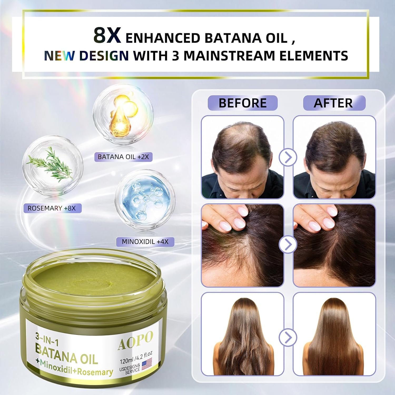 Batana Oil For Hair Growth - 3in1 Hair Serum, 4.2 oz, Batana Oil + Minoxidil + Rosemary, For Thinning Hair & Scalp Care - Image 5