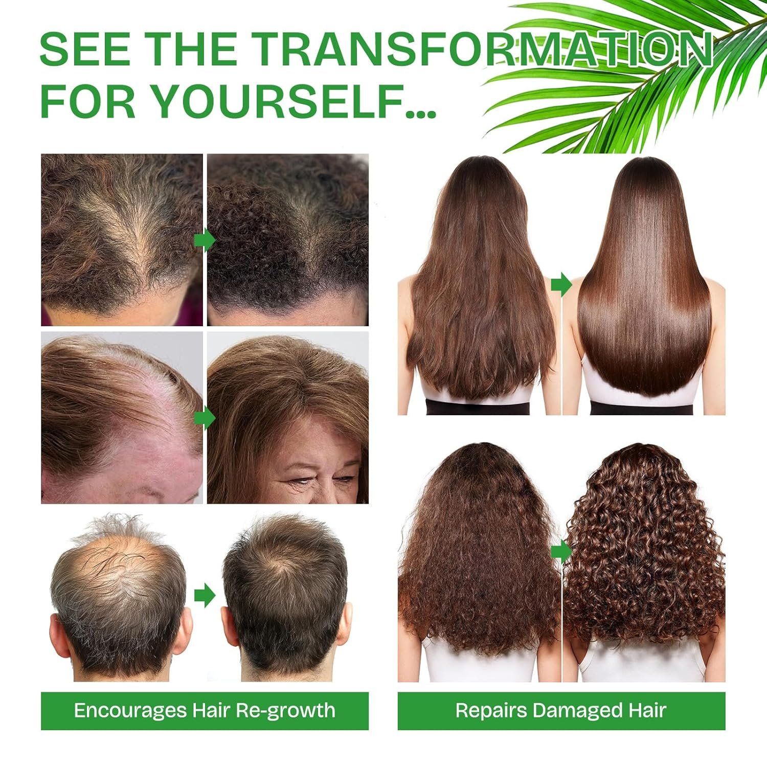 Batana Oil for Hair Growth Dr. Sebi Organic, Raw Batana Oil for Hair Growth, Unrefined Batana Oil for Hair Growth, Promote Thickness for Men & Women,Prevent Hair Loss, Repair Damaged Hair, 4.2 OZ - Image 6