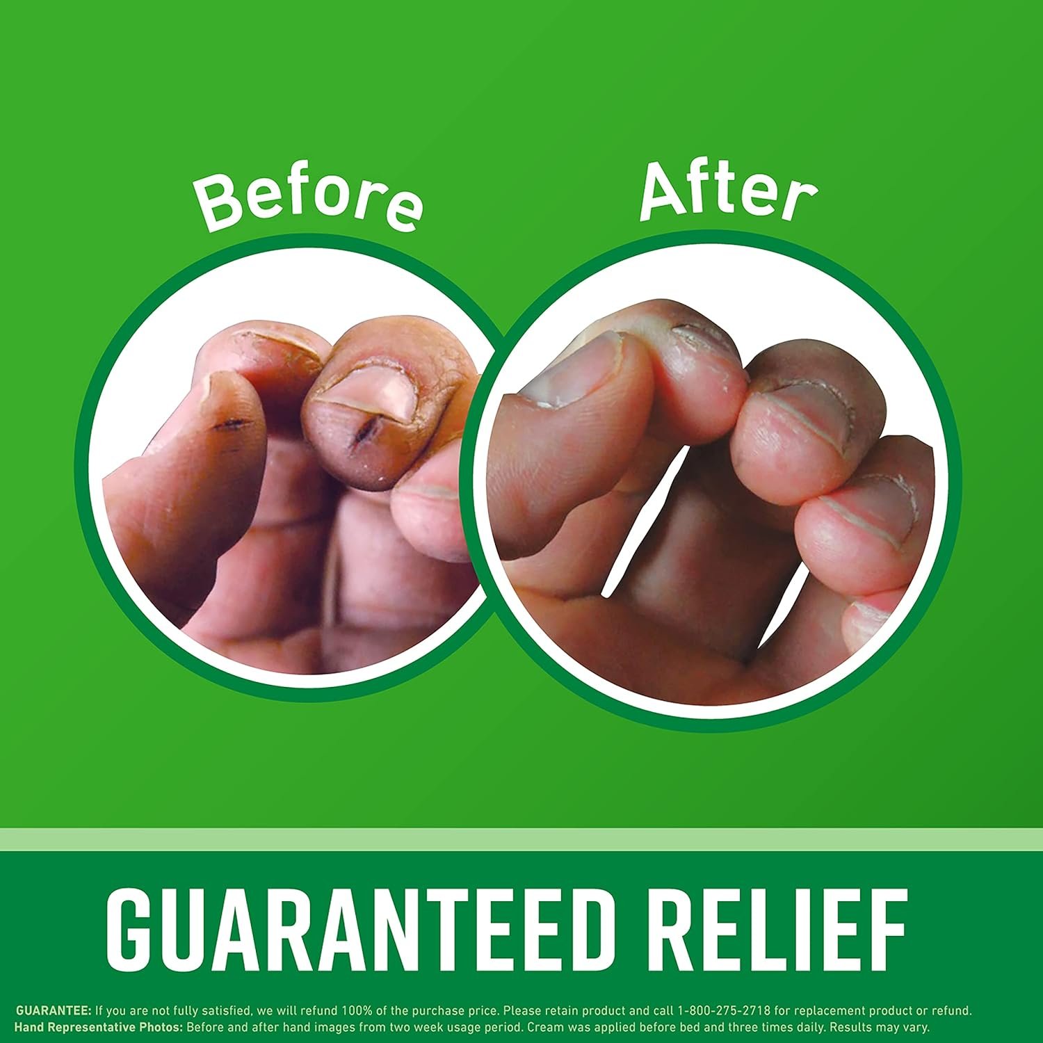 O'Keeffe's Working Hands Hand Cream; For Extremely Dry; Cracked Hands; 6.8 oz Jar (Value Size; Pack of 1) - Image 3