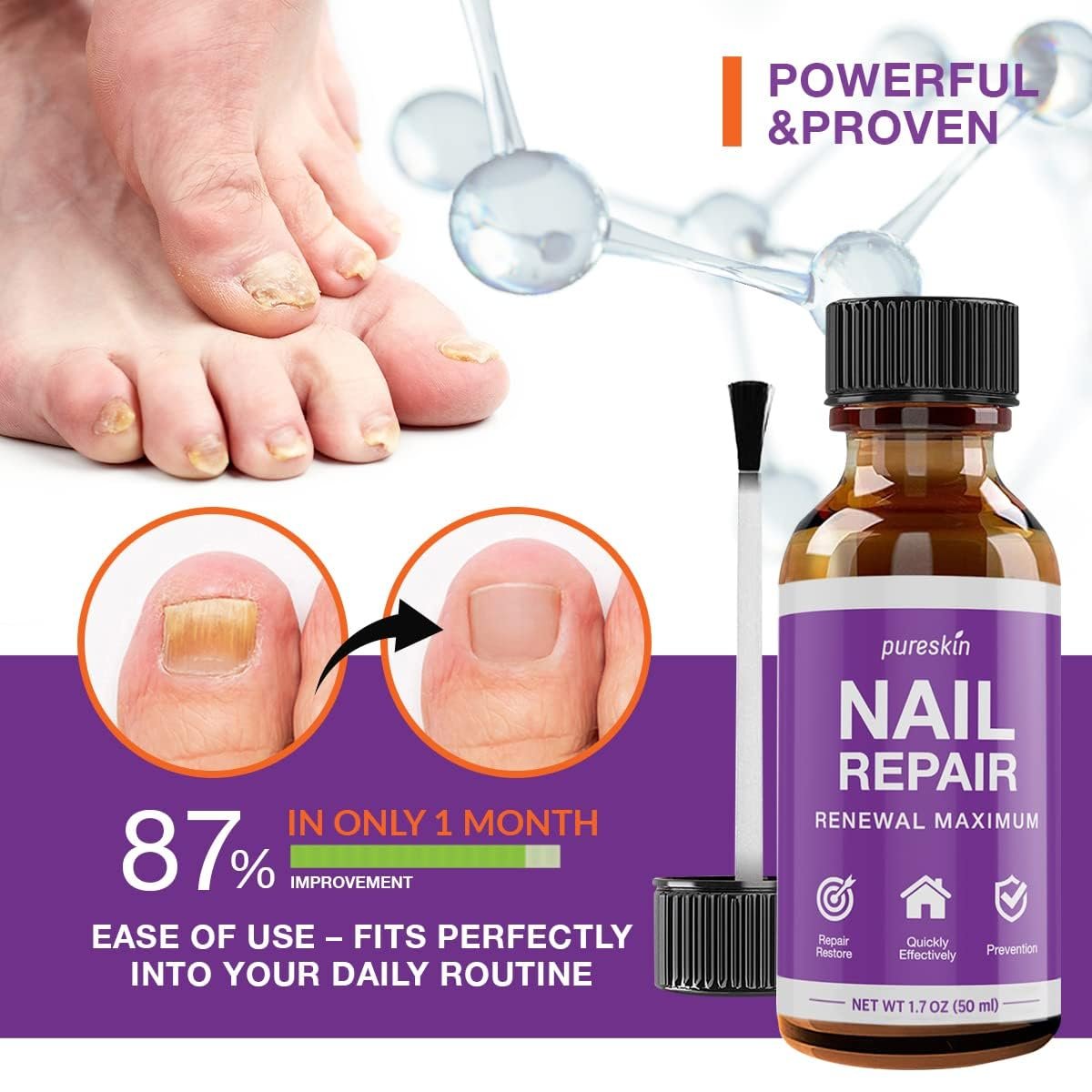 Toenail Renewal - Maximum Strength Nail Repair Liquid, Toe Nail Support, Health Care for Finger & Toenail, Athlete's Foot, Ringworm Repair-30ml - Image 4