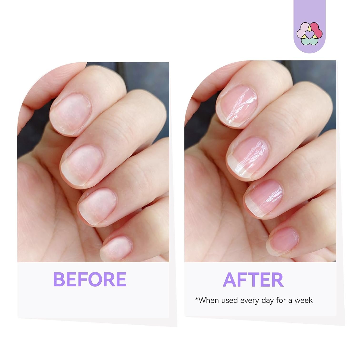 SAVILAND 3-in-1 Nail Strengthener Kit: Ultra Repair Nail Growth and Strengthener with Vitamin E Castor Oil Nail Strengthener for Damaged Nails Care Kit for Repairing Nourishing Weak Brittle Nail Home - Image 4