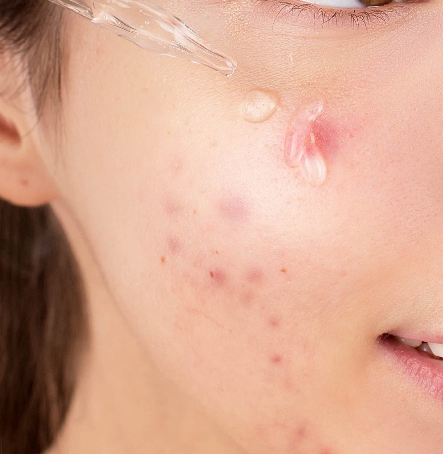 Korean Skin Care Serum Vitamin B, C Serum for Face - Niacinamide 10% Zinc 1% - K Beauty Hydrating Facial Serum - 1fl.oz.(30ml) - Image 8