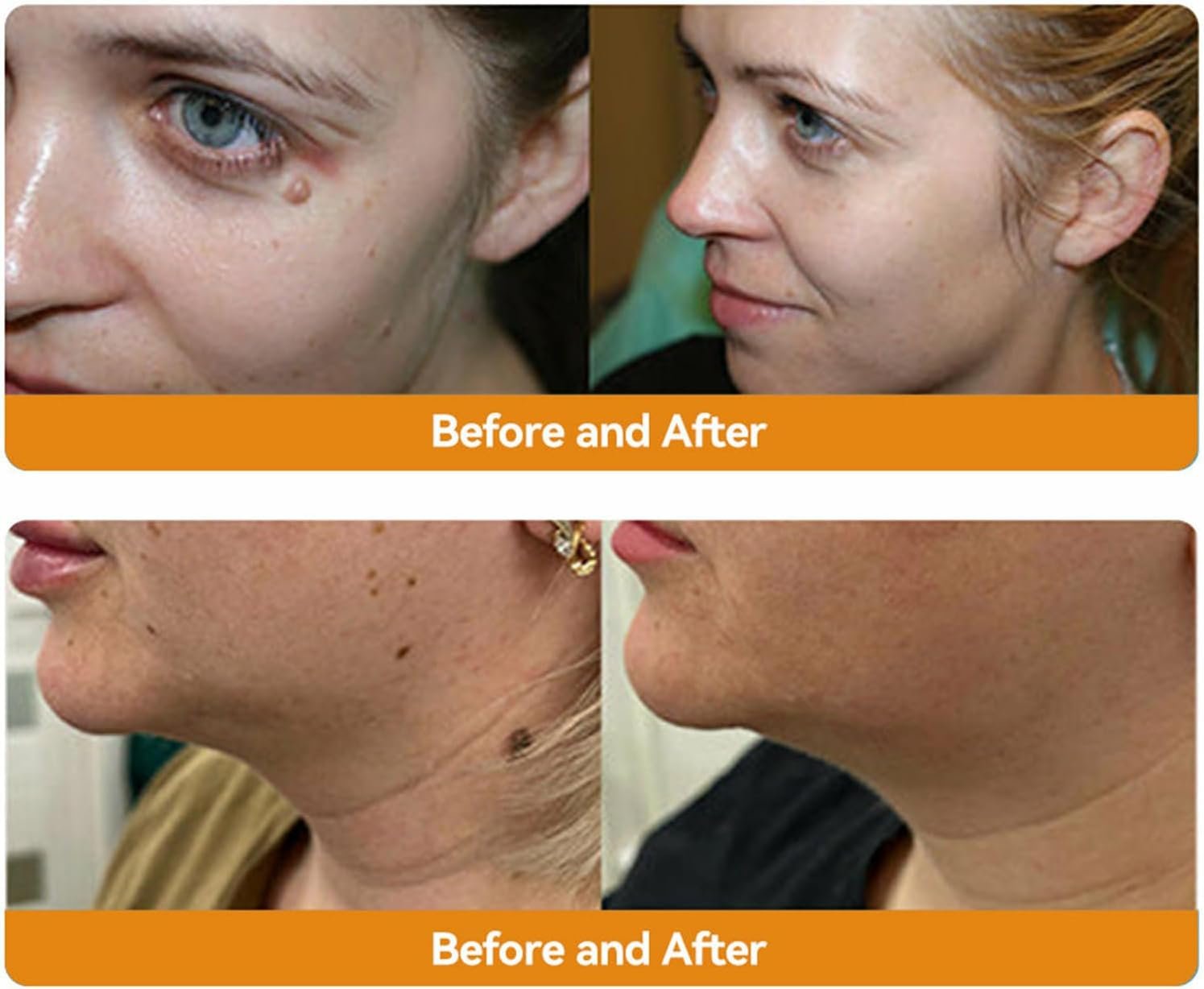 ZVLZVL Bee Venom Treament&Removal Cream,Face Moisturizers and Repair Skin for Men&Women,30ml (1) - Image 4