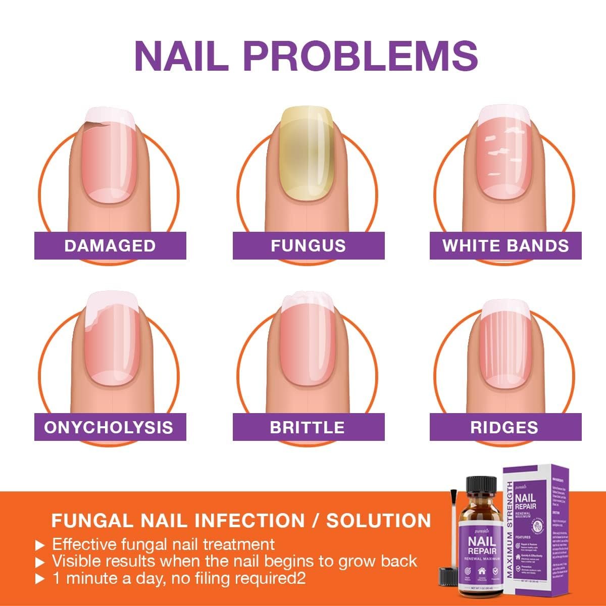 Toenail Renewal - Maximum Strength Nail Repair Liquid, Toe Nail Support, Health Care for Finger & Toenail, Athlete's Foot, Ringworm Repair-30ml - Image 3