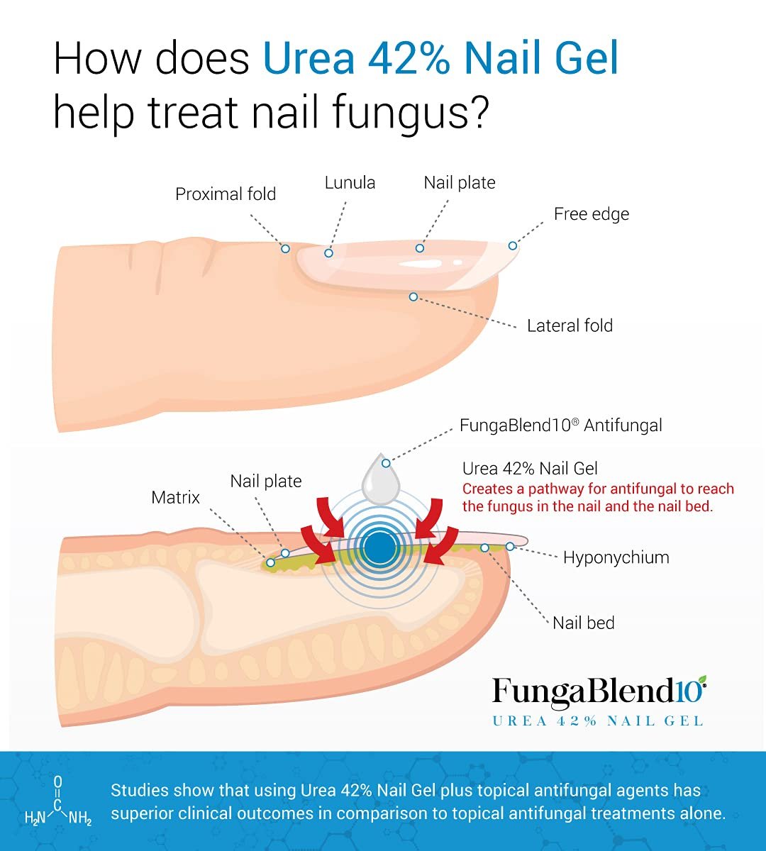 FungaBlend 10 - Urea 42% Nail Gel to Cure Fungus Faster - Delivers Antifungal Medication Directly to Fungus - Quick Results Topical Solution for Toe and Finger Nail Repair Treatment - Image 3