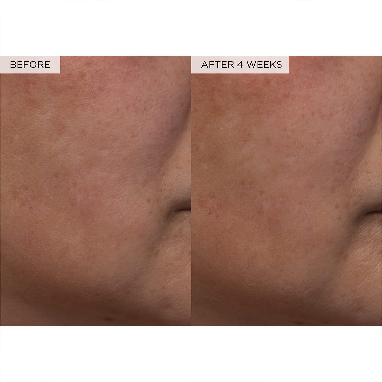 Glow Recipe PHA + BHA Face Toner - Korean Skin Care Toner, Pore Minimizer & Facial Exfoliator for Glass Skin - Tightening & Hydrating Skincare with Hyaluronic Acid & Watermelon (40ml) - Image 10