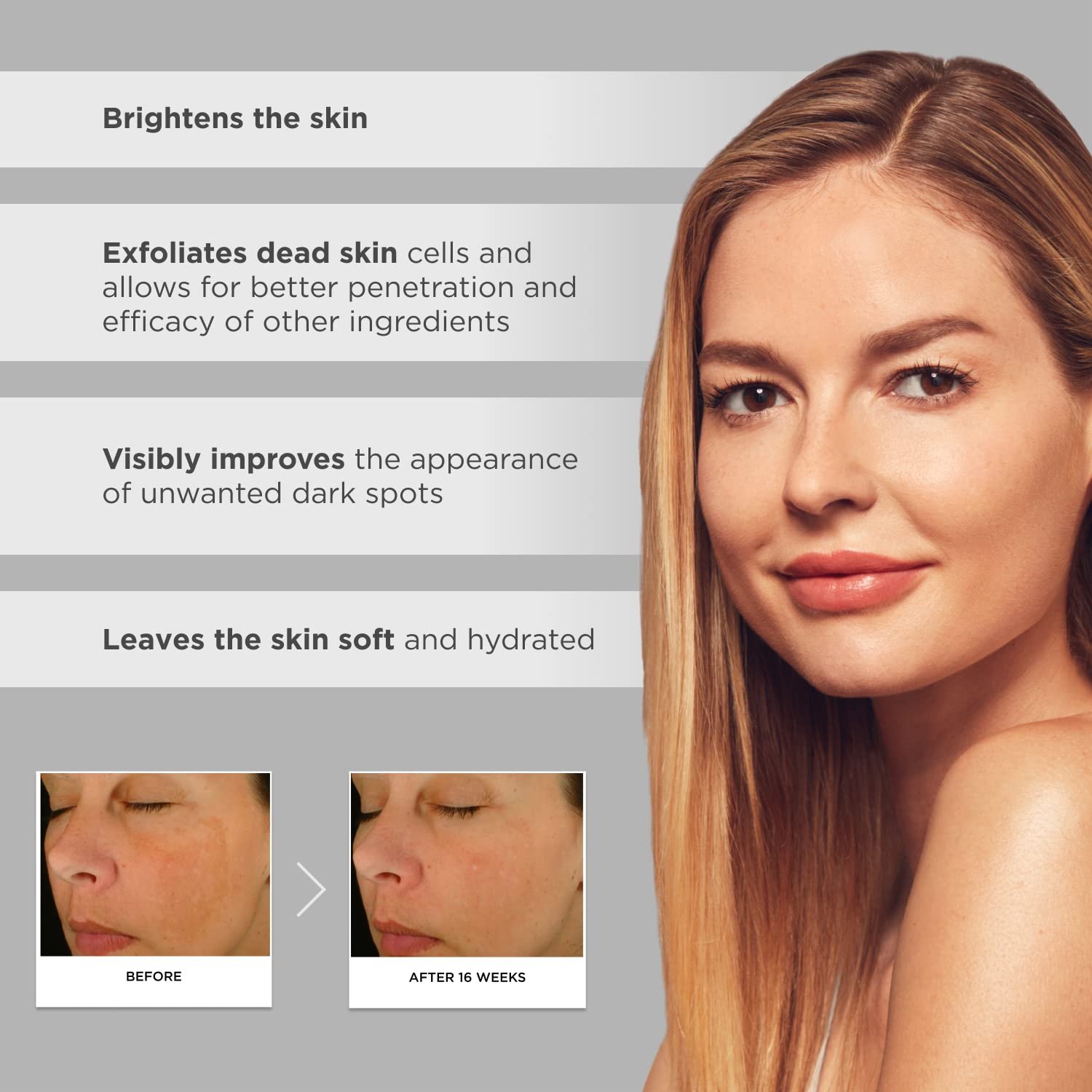 Glytone Enhance Brightening Complex - With 12% Azelaic Acid, 3% Glycolic Acid - Brightens Skin & Reduces Dark Spots - Non-Comedogenic - 1 fl. oz. - Image 6
