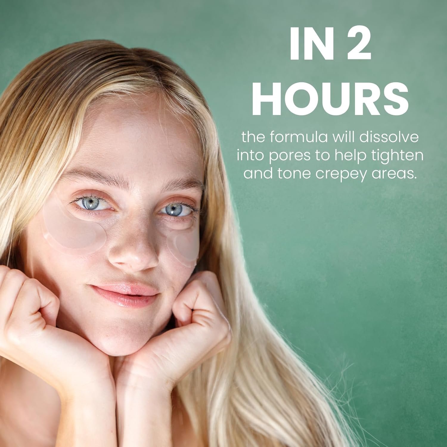 Skyn ICELAND Dissolving Microneedle Under Eye Patches With 39% Hyaluronic Acid & Peptides. No-Slip Eye Mask to Firm And Reduce Wrinkles & Fine Lines, 1 Pair - Image 4