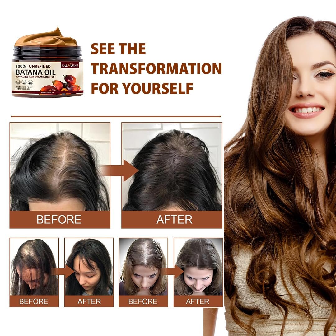 Batana Oil for Hair Growth,100 Percent Natural, Pure, Unrefined, Repair Damaged Hair, Prevent Hair Loss & Boost Thickness for Men & Women, 4.05 Ounce. - Image 7