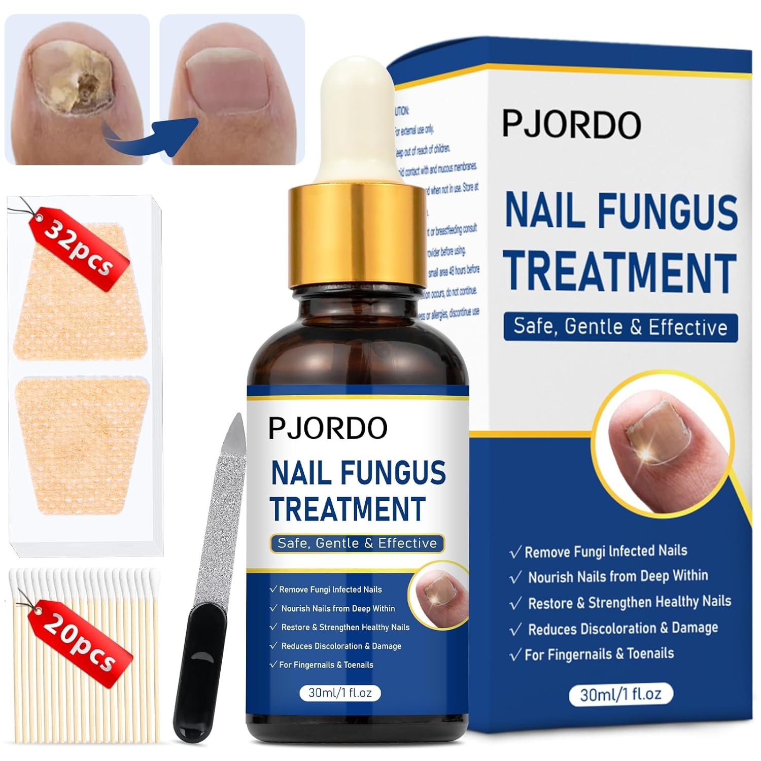 Toenail Repair Treatment Extra Strength with 32pcs Nail Repair Patches, Nail Repair Solution for Toenail & Fingernail, Nail Repair Treatment for Athletes Foot, Thick, Discolored, Damaged Nails - Image 2