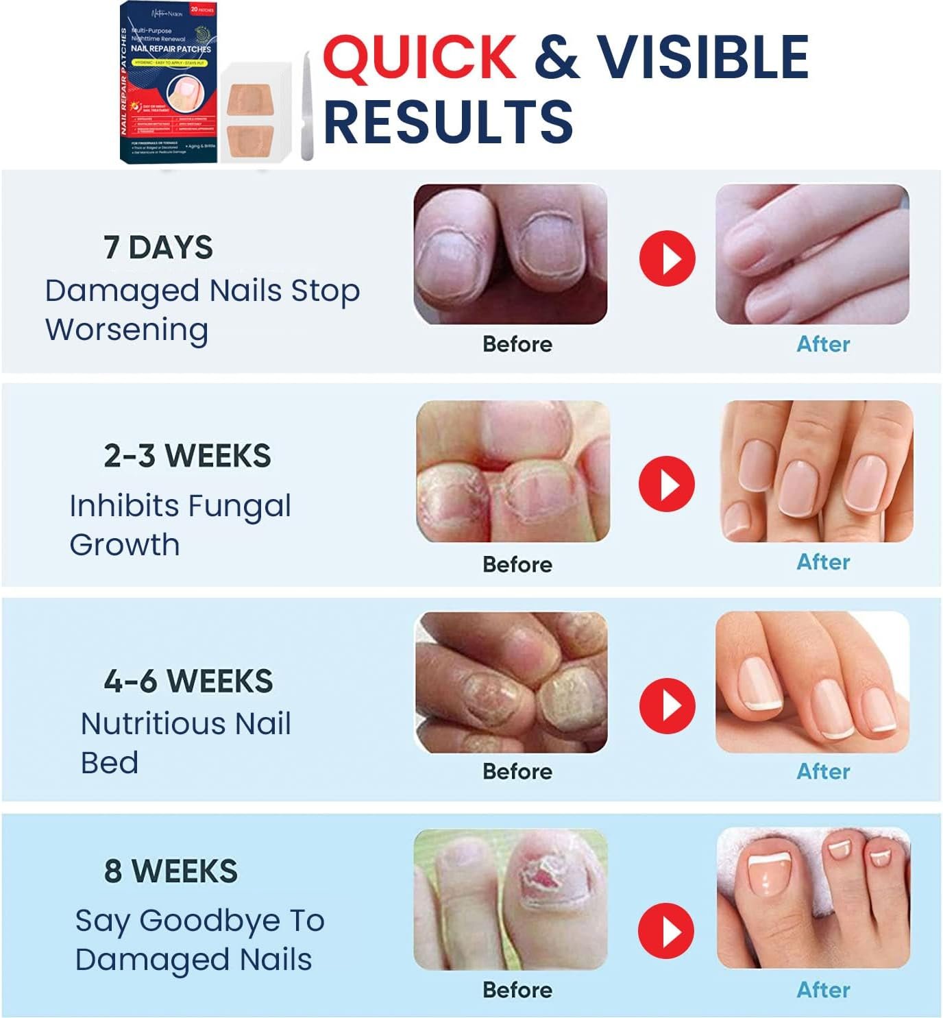 Toenail Fungus Treatment for Nail Repair: Nail Fungus Treatment Extra Strength - Toe Nail Fungus Treatments Fungus Nail Treatment for Toenail and Fingernail - Nighttime Renewal Fungal Nail Patches - Image 6