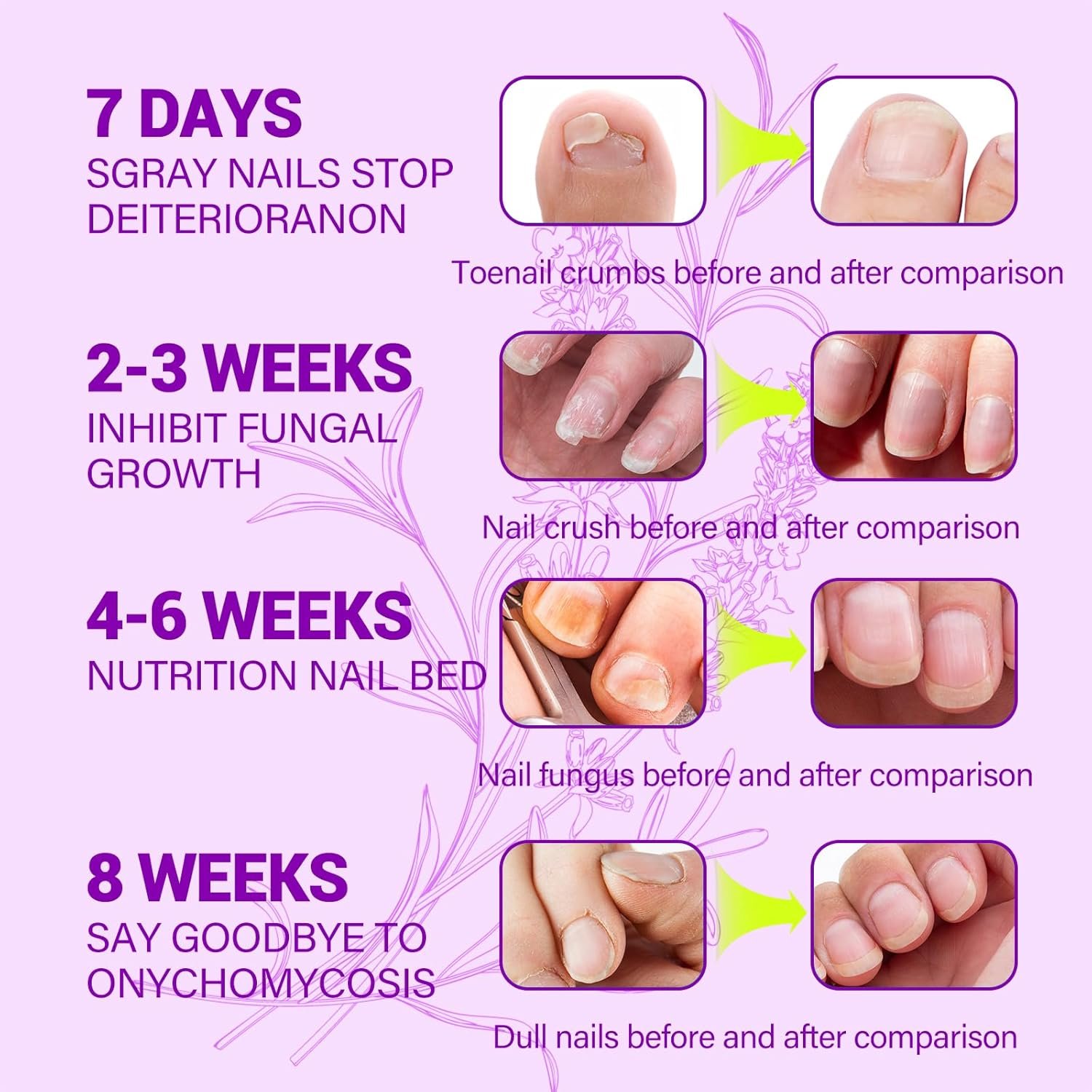 Toenail Fungus Treatment Extra Strength, Toe Nail Fungus Treatment with Naturally & Safely, Nail Fungus Treatments for Toenail Extra Strength for Thick, Broken, Discolored & Damaged Nail - Image 7