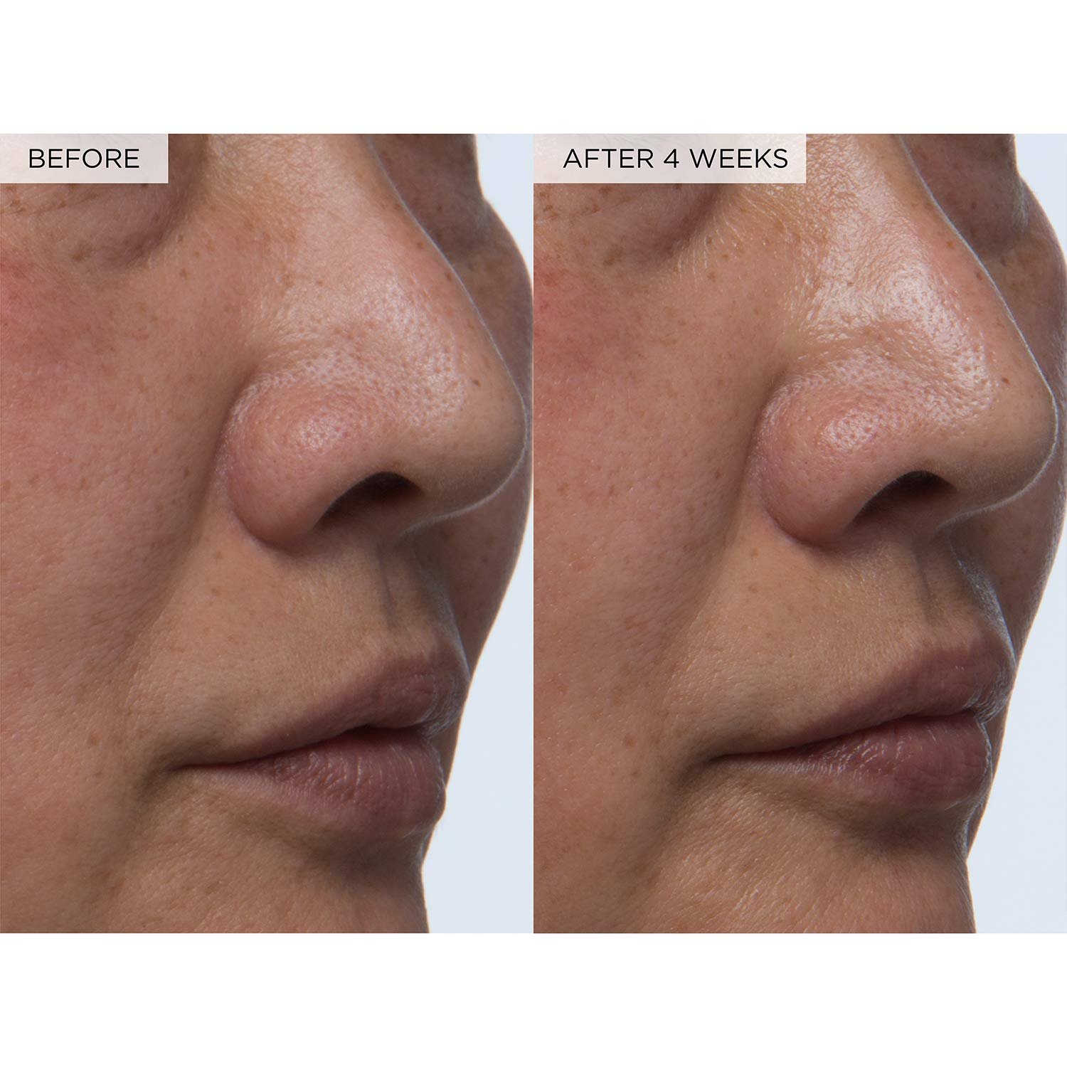 Glow Recipe PHA + BHA Face Toner - Korean Skin Care Toner, Pore Minimizer & Facial Exfoliator for Glass Skin - Tightening & Hydrating Skincare with Hyaluronic Acid & Watermelon (40ml) - Image 9