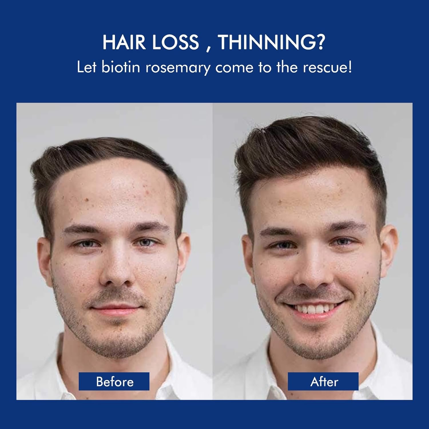 Ceson&Cesun Hair Growth Shampoo Organics Anti-Thinning Biotin Thickening Shampoo Infused with Rosemary, CLINICALLY TESTED Effective - Strengthening Hair Thickening Products for Men & Women 10.1 Oz - Image 4