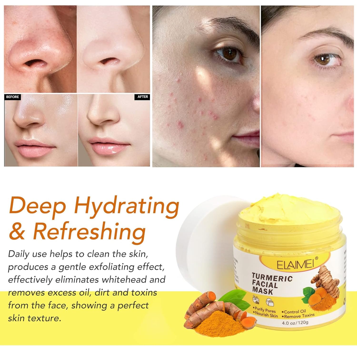 AUSTINE Turmeric Vitamin C Clay Mask for Face,Deep Cleansing Facial Mask for Dark Sport.face mask skin care for Moisturizing and Oil Control,Reduce Blackheads and Acne(4.0oz - Image 6