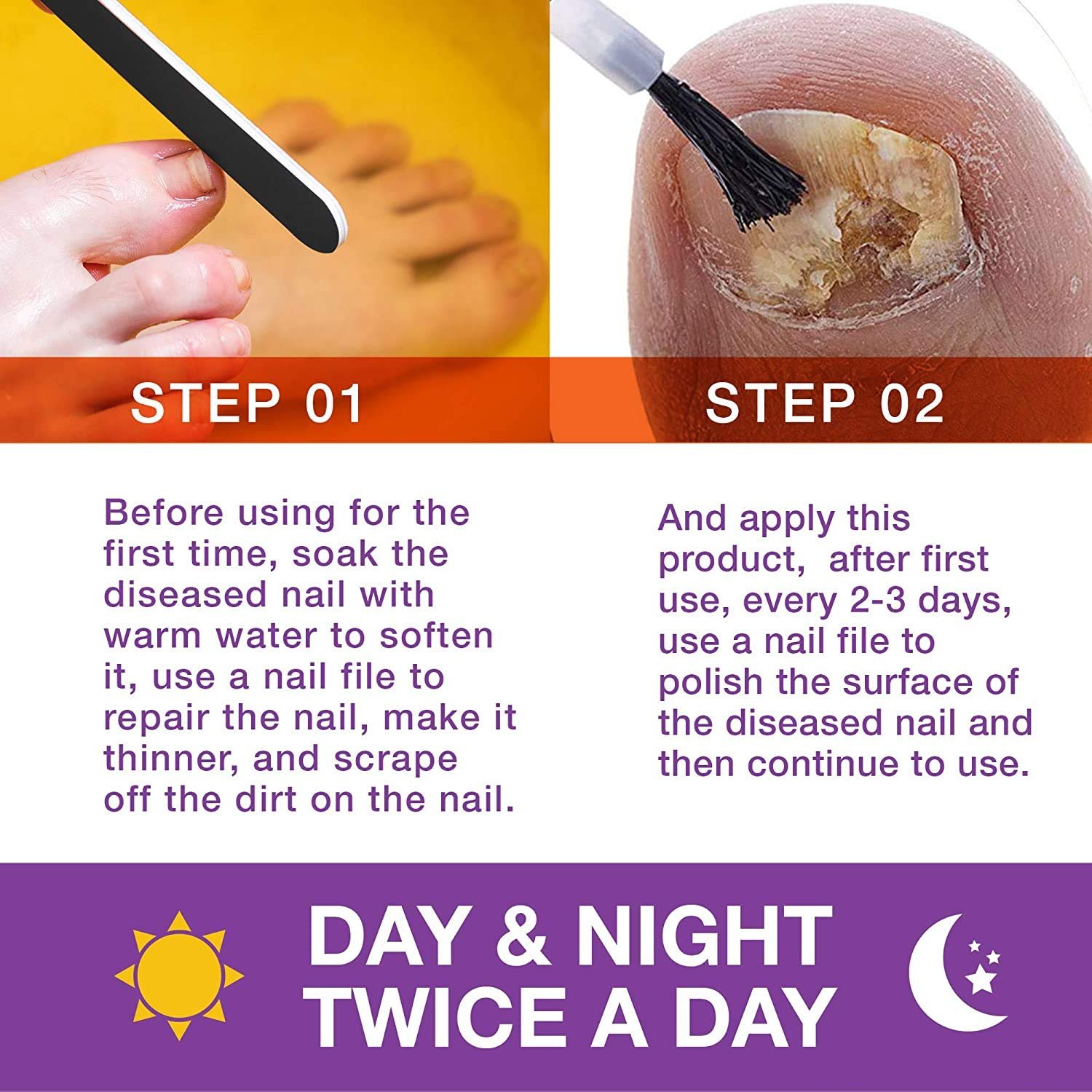 Toenail Renewal - Maximum Strength Nail Repair Liquid, Toe Nail Support, Health Care for Finger & Toenail, Athlete's Foot, Ringworm Repair-30ml - Image 5