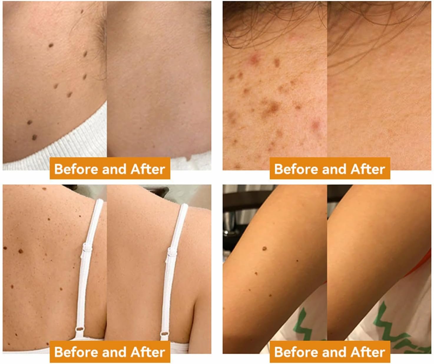 ZVLZVL Bee Venom Treament&Removal Cream,Face Moisturizers and Repair Skin for Men&Women,30ml (1) - Image 3