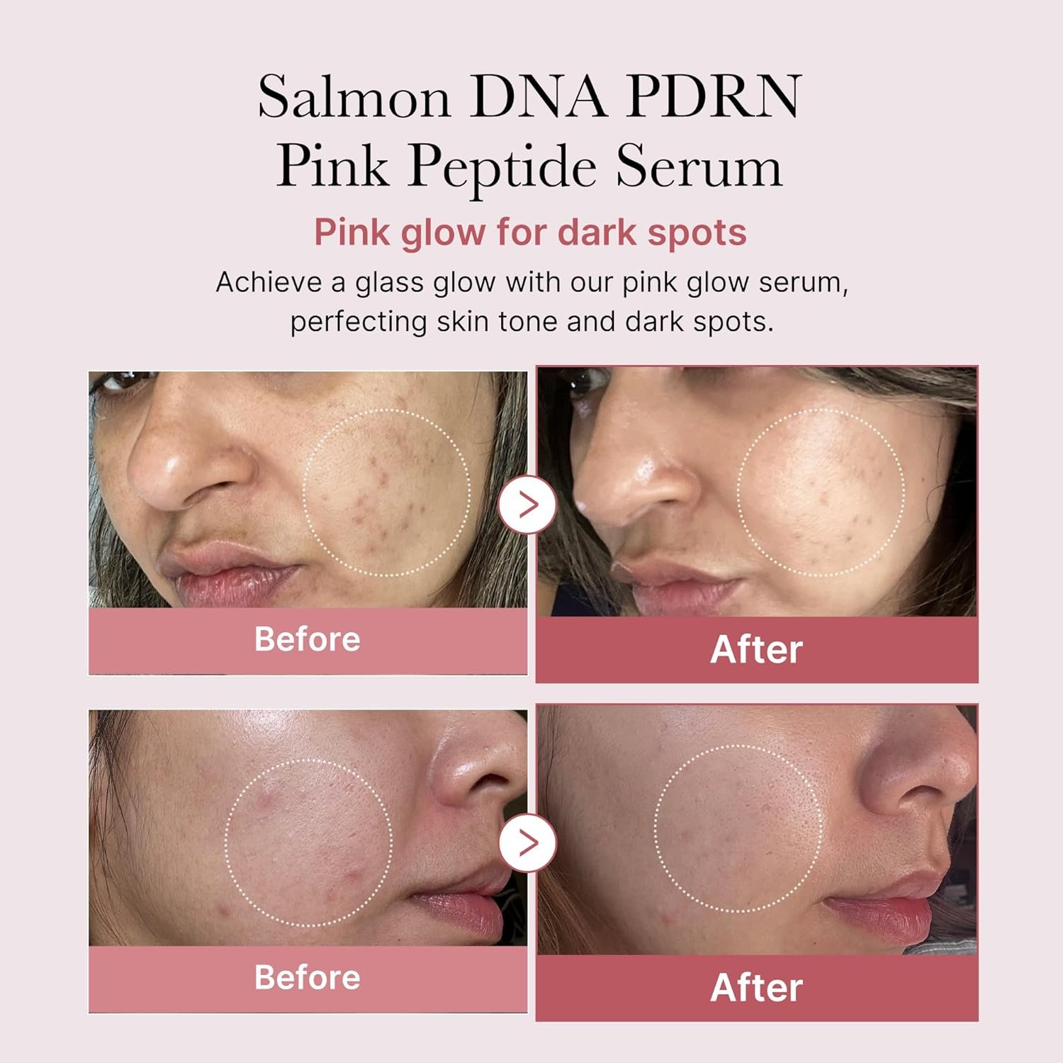 medicube Salmon DNA PDRN Pink Peptide Serum, Pink glow serum, Peptide, Niacinamide, Hydrating & Moisturizing & Firming, Uneven Skin Tone, Korean Skincare | 1.01 fl.oz. (1.01 fl.oz., Salmon DNA PDRN) - Image 3