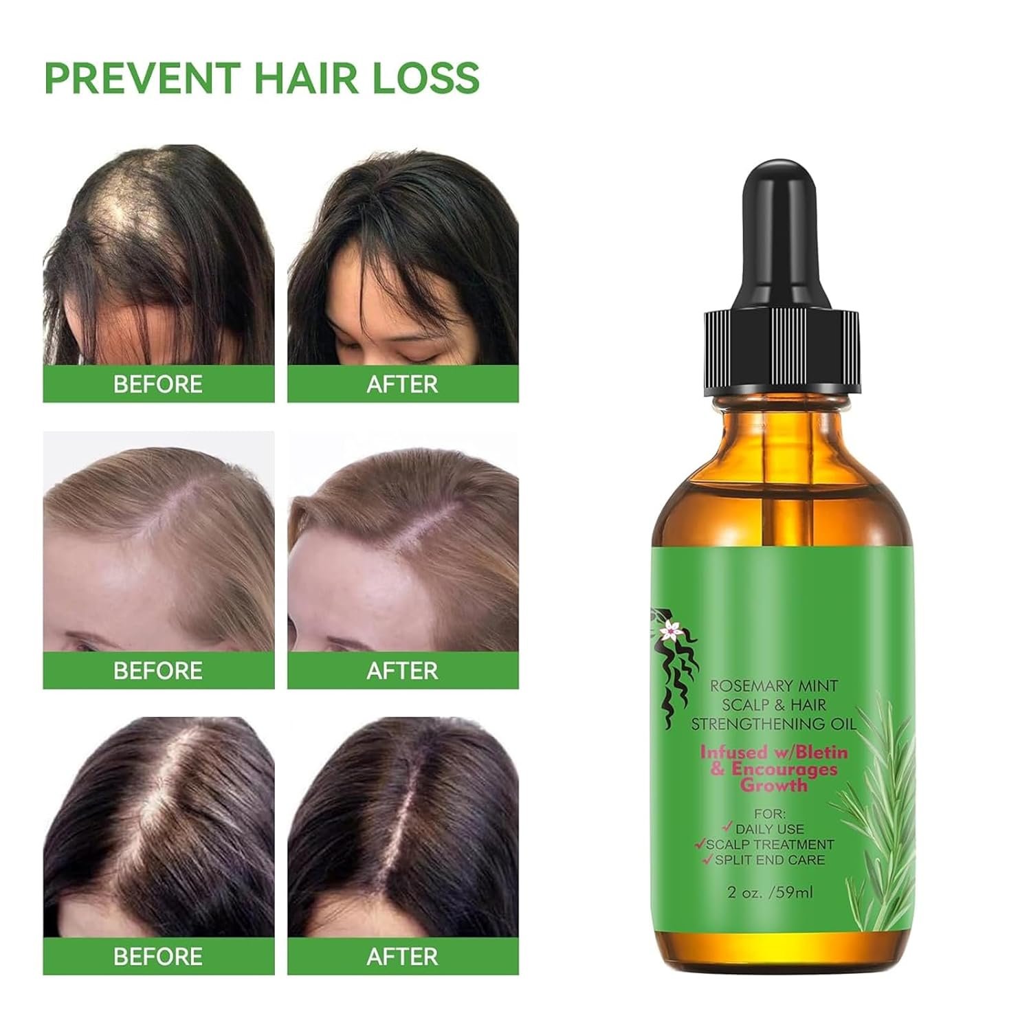 Rosemary Hair Growth Oil and Serum - Dry Scalp Treatment, Hair Thickening Products for Women, Hair Loss Essential Oils for Diffuser (2OZ) - Image 4