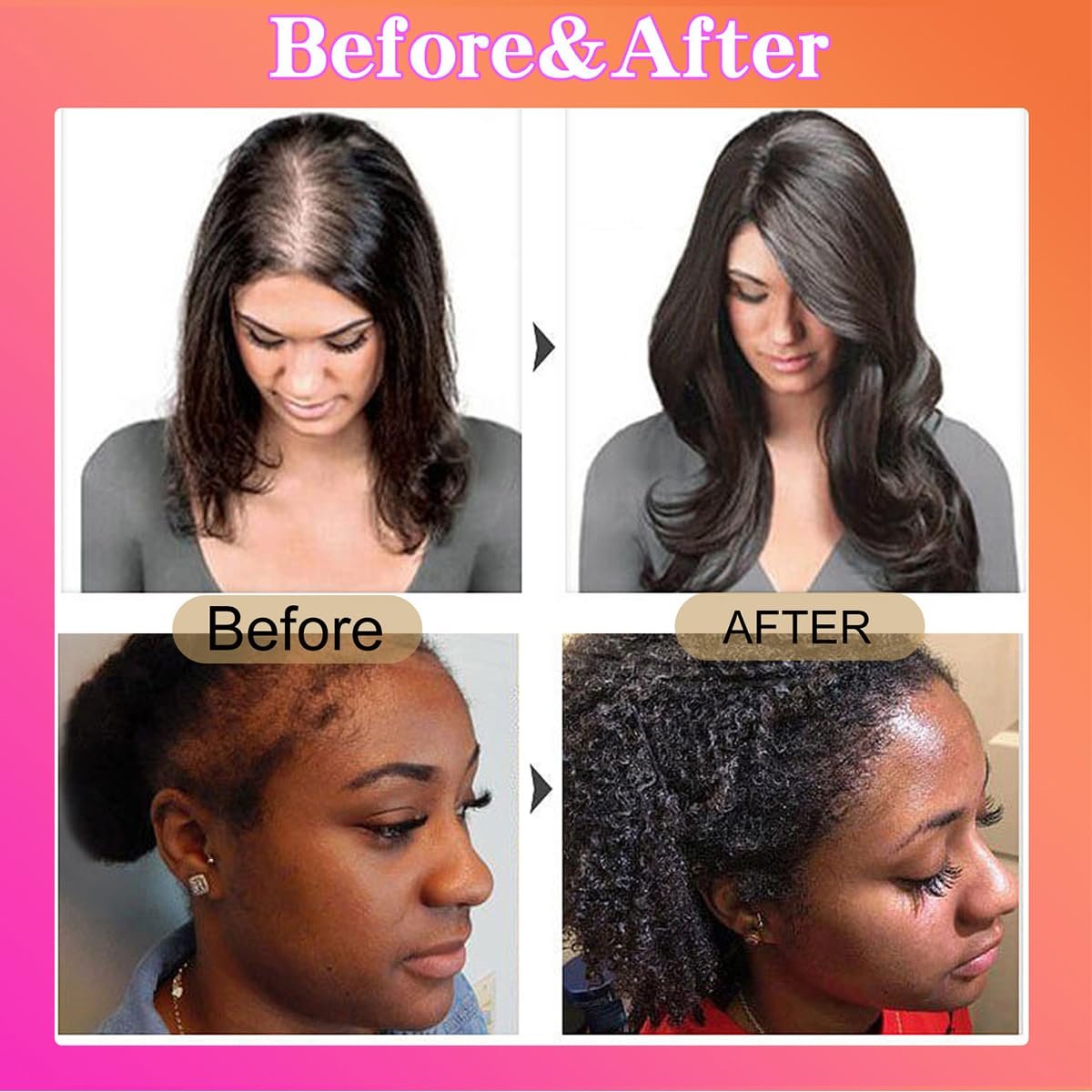 2Pcs Raw Batana Oil for Hair Health,100% Natural,Pure,Unrefined and Authentic Cold Pressed Organic Sebi Batana Oil from Honduras,Prevent Hair Loss Repairs Damaged,for Men and Women - Image 4