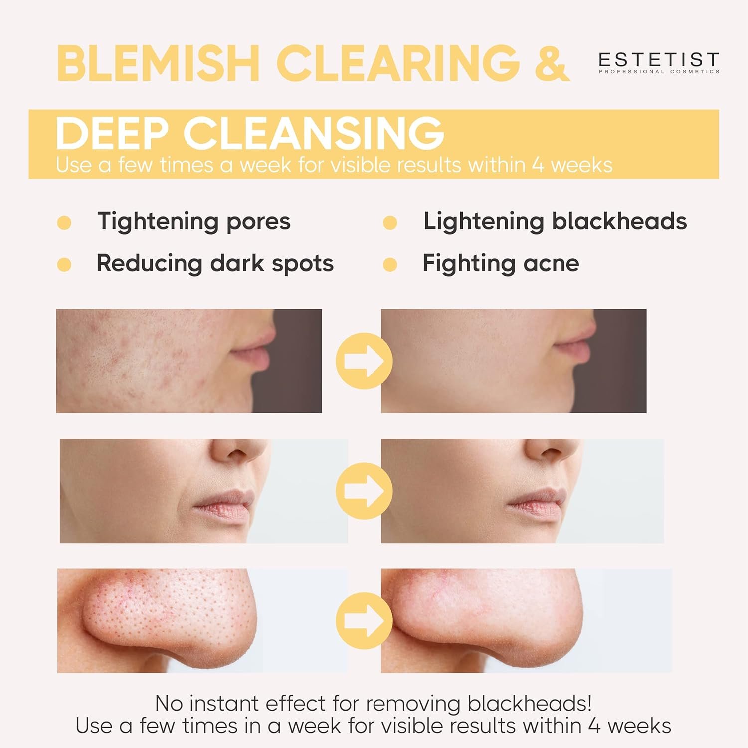 ESTETIST Turmeric Vitamin C Clay Face Mask Stick Set For Dark Spots Oil Control and Balance Facial Mask Deep Pore Cleanser Blackhead Remover Anti-Acne Treatment for All Skin Types Gift Pack of 3 - Image 5