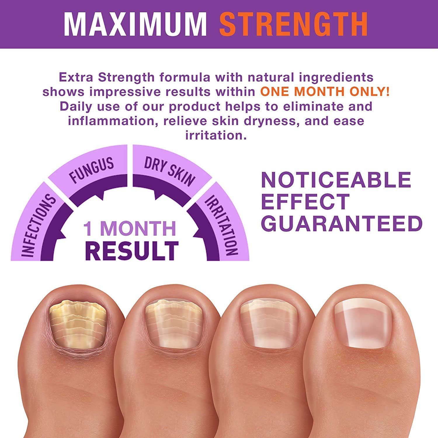 Toenail Renewal - Maximum Strength Nail Repair Liquid, Toe Nail Support, Health Care for Finger & Toenail, Athlete's Foot, Ringworm Repair-30ml - Image 6