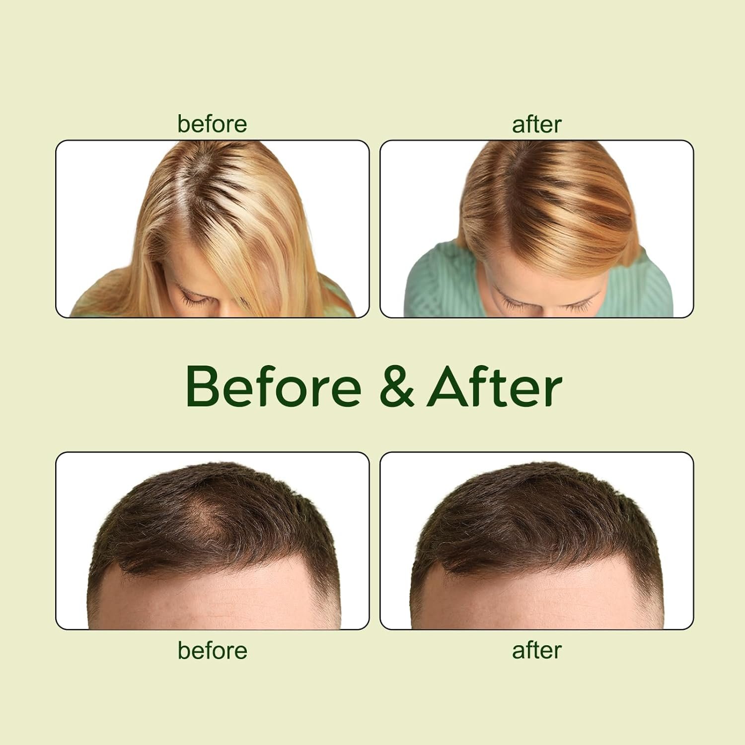Veganic Natural Hair Growth Oil Kit, Veganic Hair Growth Oil Kit with Rosemary Oil, Castor Oil, Argan Oil, Raw Batana Oil, Veganic Hair Oil for Hair Growth 2pcs. - Image 7