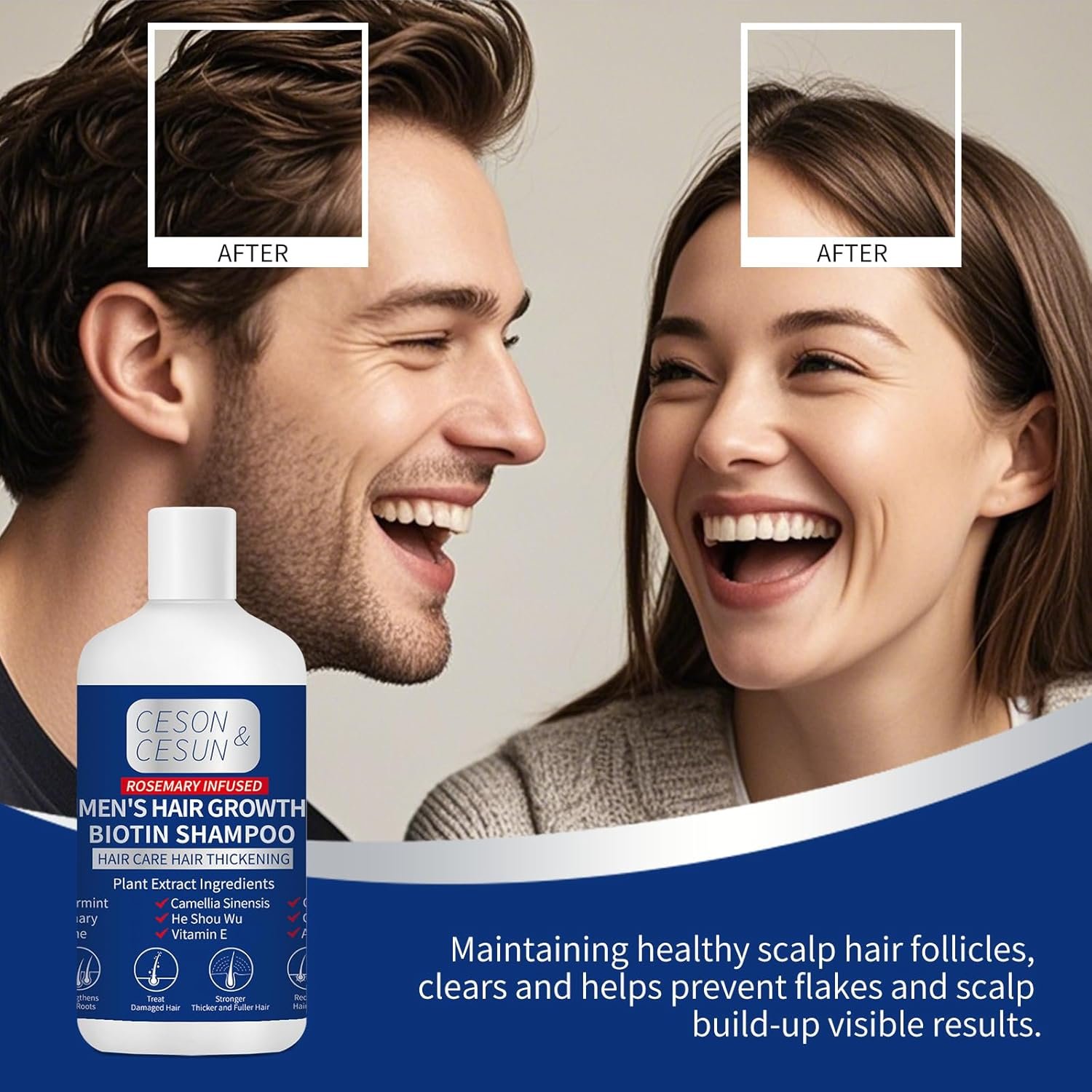 Ceson&Cesun Hair Growth Shampoo Organics Anti-Thinning Biotin Thickening Shampoo Infused with Rosemary, CLINICALLY TESTED Effective - Strengthening Hair Thickening Products for Men & Women 10.1 Oz - Image 12