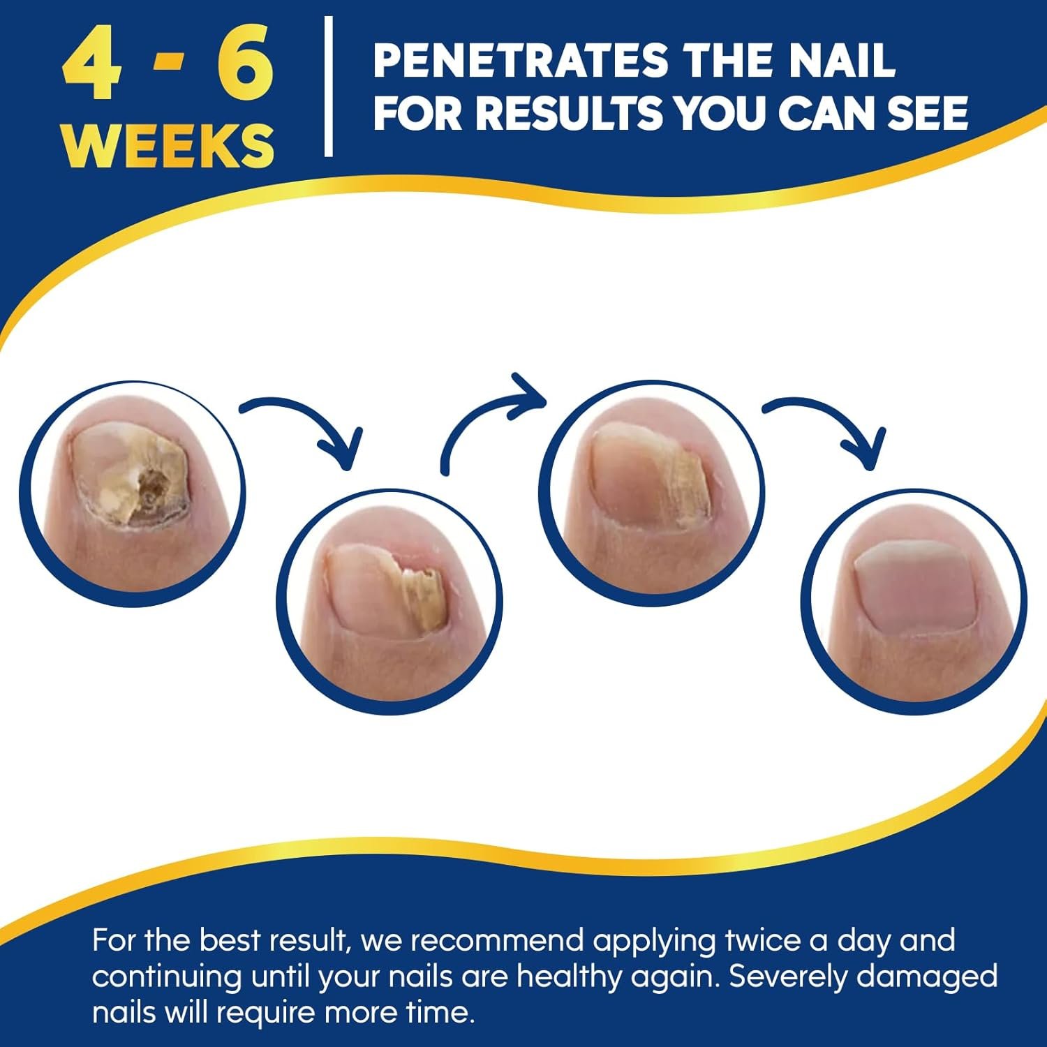 Toenail Repair Treatment Extra Strength with 32pcs Nail Repair Patches, Nail Repair Solution for Toenail & Fingernail, Nail Repair Treatment for Athletes Foot, Thick, Discolored, Damaged Nails - Image 5