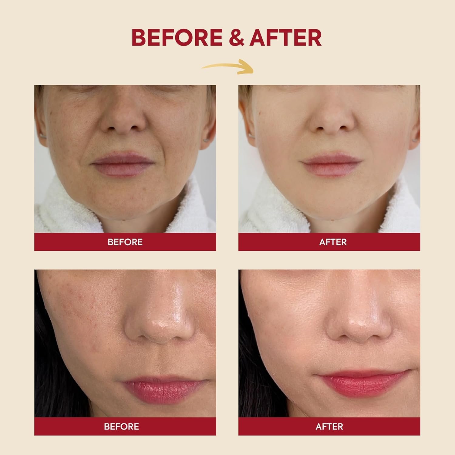 K-SECRET Snail Mucin Essence Serum: 97% Snail Secretion with Rice Ferment Filtrate and Rice Extract for Skin Hydration Soothing and Balancing - SEOUL 1988 Korean Skincare 100mL - Image 5