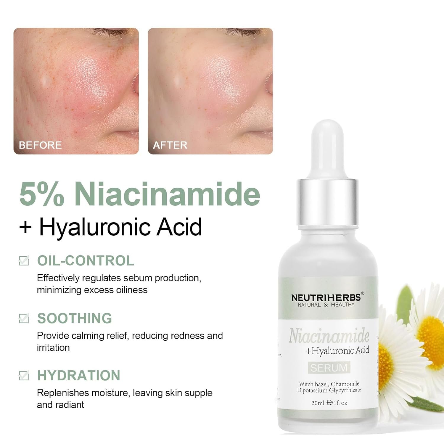 Neutriherbs 4% Niacinamide Serum for Face the Ordinary + HA,Effectively Work to Control Excess Facial Oil, Minimize the Pores and Prevent Breakouts, Best Niacinamide Serum For Oily Skin - Image 8