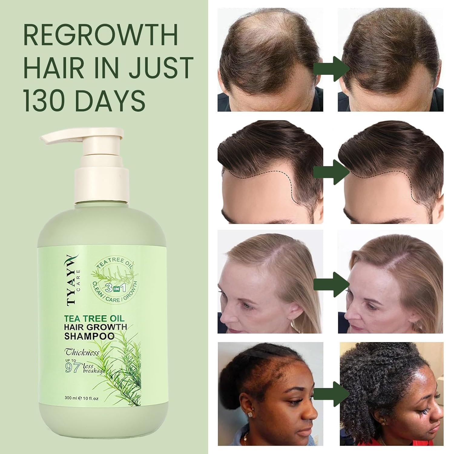 Rosemary Hair Growth Shampoo 3-In-1, Tea Tree Thickening Shampoo for Hair Regrowth, Strengthening Mint Biotin Shampoo for Thinning Hair and Hair Loss Soothes Scalp for Men & Women, 300ml - Image 3