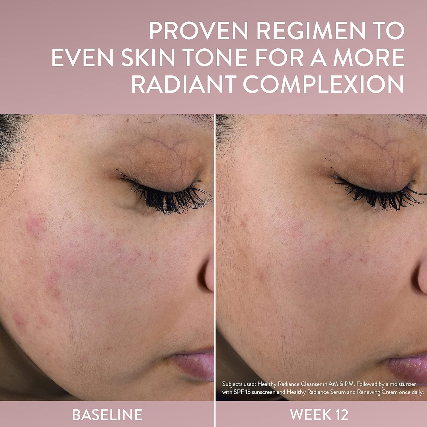 Cetaphil Face Cream, Healthy Radiance Renewing Cream, Visibly Reduces Look of Dark Spots, Brightening Lotion, Designed for Sensitive Skin, Hypoallergenic, Fragrance Free, 1.7oz - Image 6