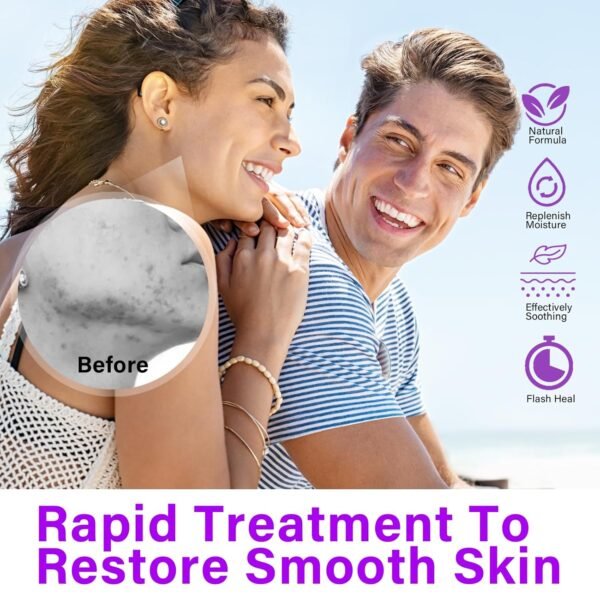 Zmaomaoy Azelaic Acid Cream, Azelaic Acid 12% Facial Serum,Skin Hyaluronic Acid and Niacinamide, Redness Relief - Image 3