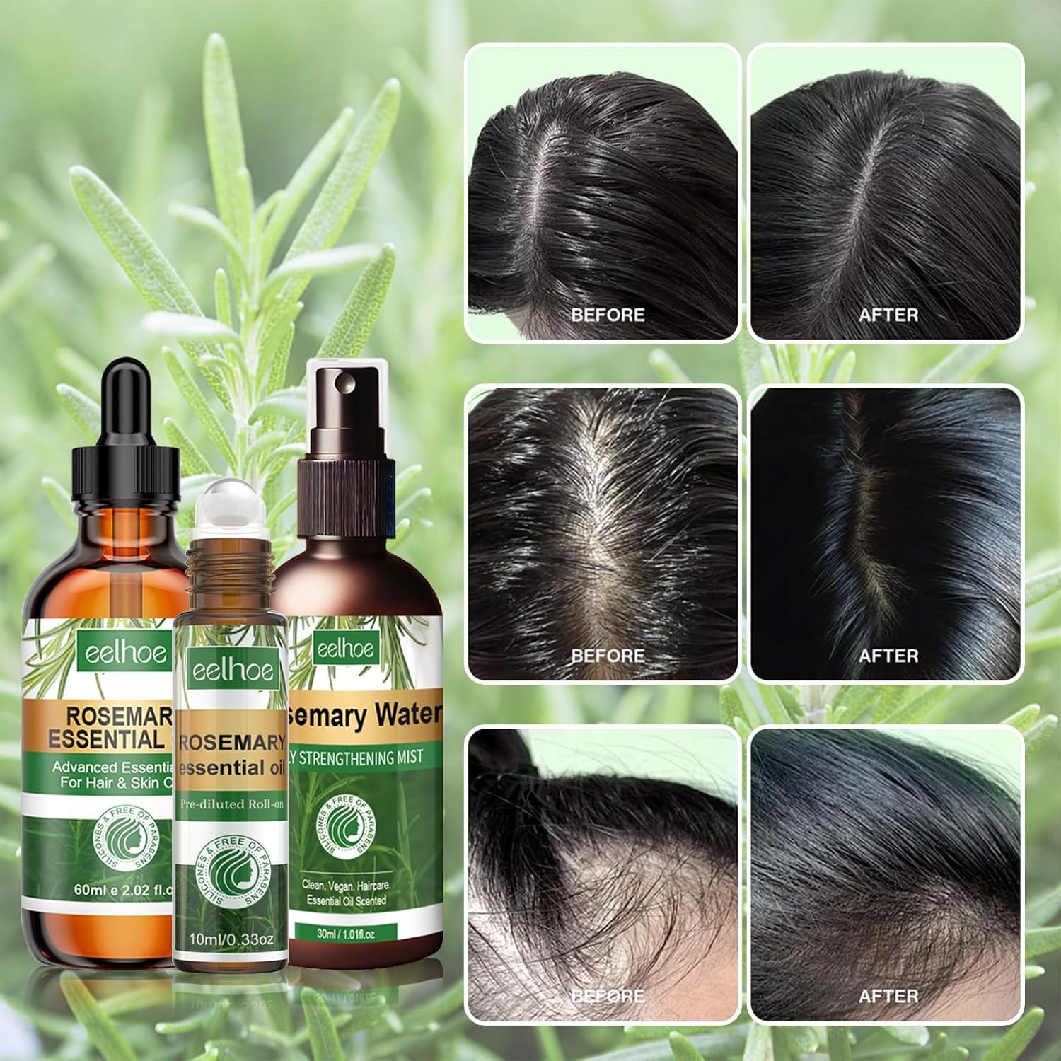 Rosemary Essential Oil 3-Piece Gift Set: Pure Organic Growth Treatment, Water Spray for Dry Scalp and Hair Loss - Image 4