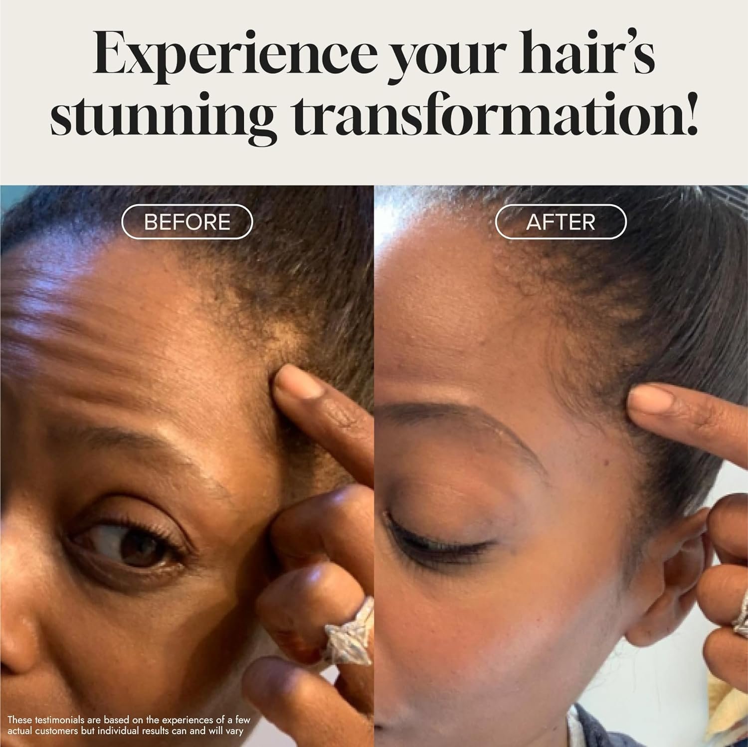 Biotin Hair Growth Serum Advanced Topical Formula To Help Grow Healthy, Strong Hair Suitable for Men and Women of All Hair Types Hair Loss Support By Pureauty Naturals 2 Fl Oz (Pack of 1) - Image 5