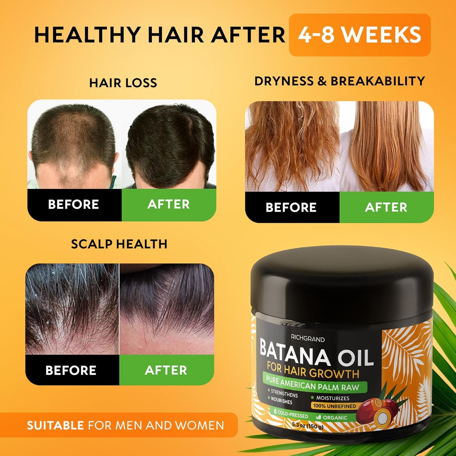 Batana Oil for Hair Growth - 100% Raw & Organic Cold-Pressed Batana Oil - Pure Unrefined Batana Hair Mask for Men & Women - Strengthens Hair, Prevents Loss, Repairs Split Ends - 5.3 Fl Oz - Image 4