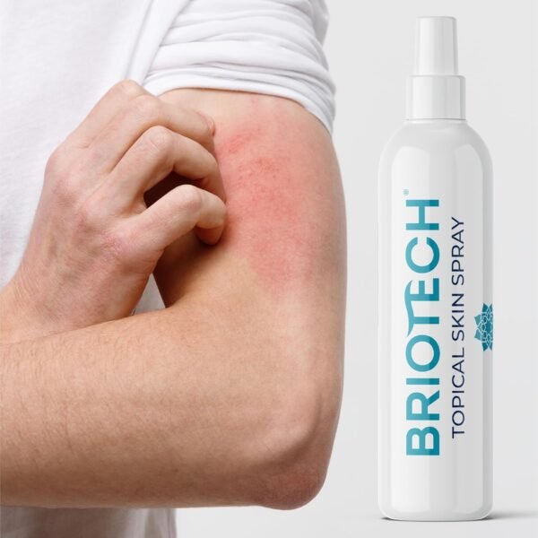 BRIOTECH Topical Skin Spray, Hypochlorous Acid Spray for Body & Face, Eyelid Cleanser, HOCl Facial Mist, Support Against Irritation and Redness, Stocking Stuffers, Packaging May Vary, 4 oz, 1 ct - Image 6