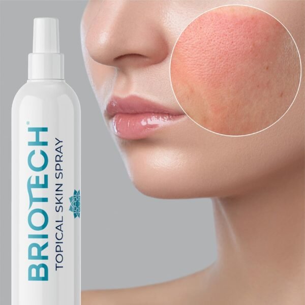 BRIOTECH Topical Skin Spray, Hypochlorous Acid Spray for Body & Face, Eyelid Cleanser, HOCl Facial Mist, Support Against Irritation and Redness, Stocking Stuffers, Packaging May Vary, 4 oz, 1 ct - Image 5