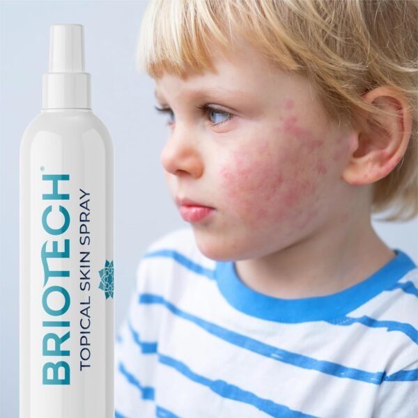 BRIOTECH Topical Skin Spray, Hypochlorous Acid Spray for Body & Face, Eyelid Cleanser, HOCl Facial Mist, Support Against Irritation and Redness, Stocking Stuffers, Packaging May Vary, 4 oz, 1 ct - Image 7
